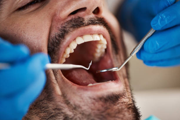 Best Teeth Whitening  in Barboursville, WV